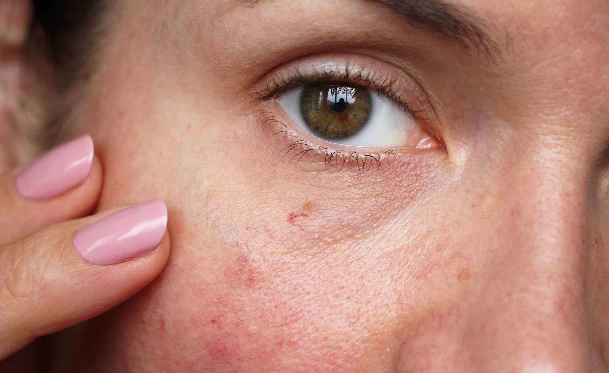 What Makes Skin Sensitive? And the Best Makeup for Sensitive Skin