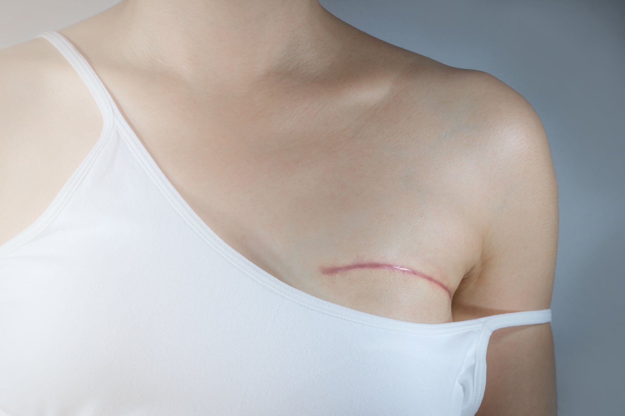 How to Cover Mastectomy Scars with The Best Makeup