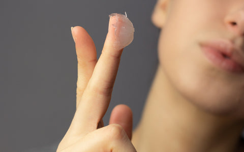 Is Slugging Safe for Acne-Prone Skin?