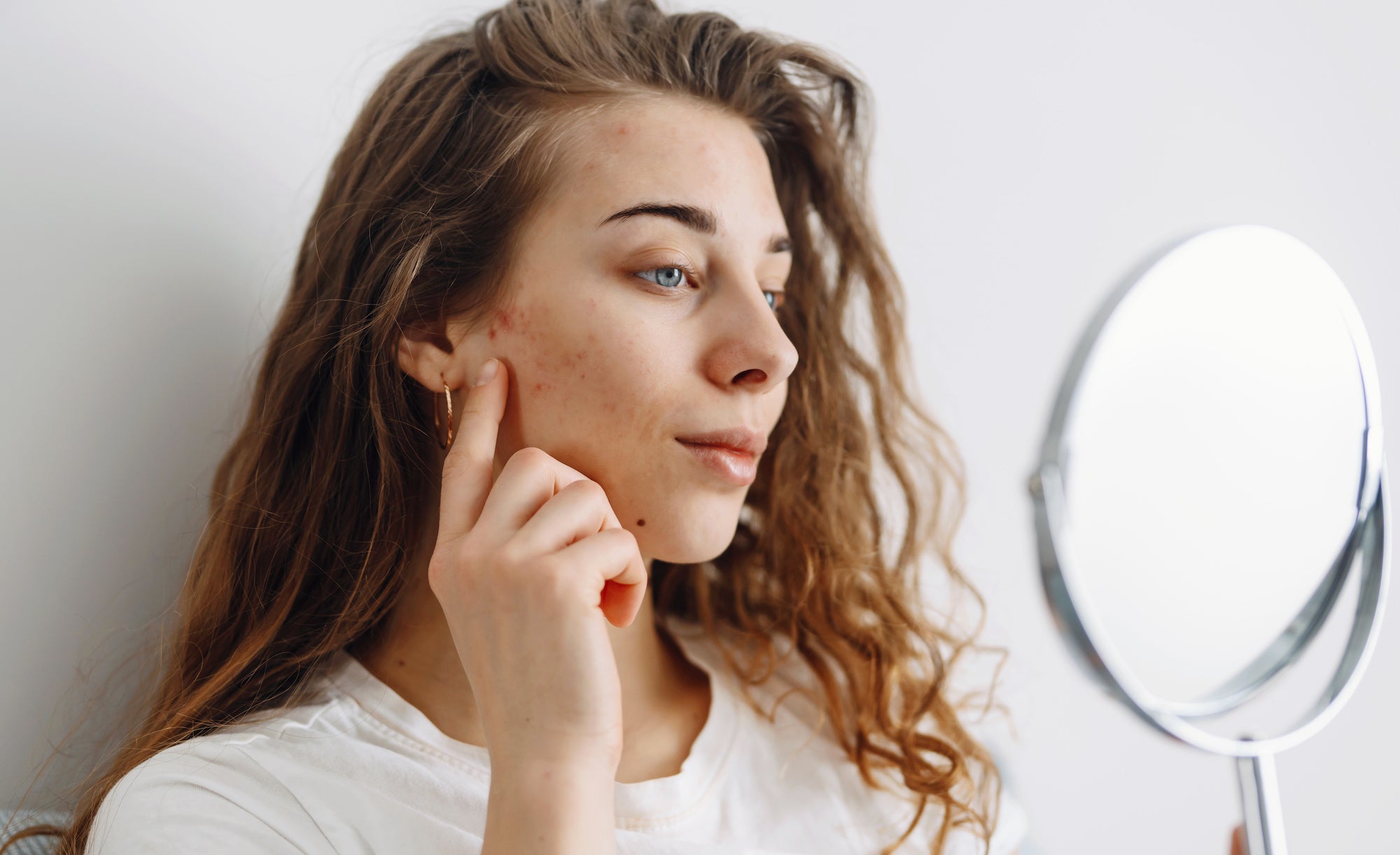 How To Cover a Pimple with Makeup That Actually Unclogs Pores