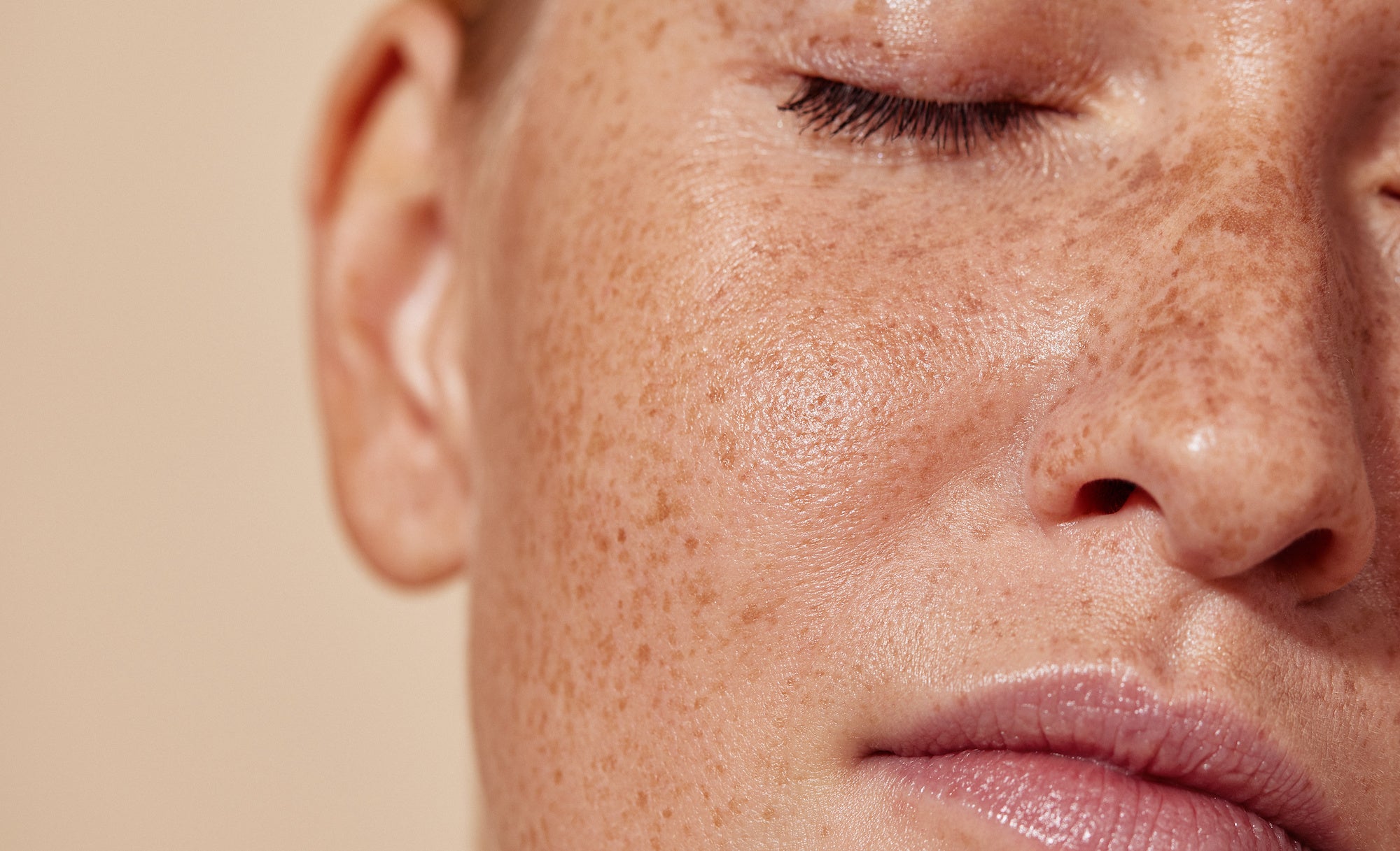 5 Ways to Embrace Your Natural Freckles