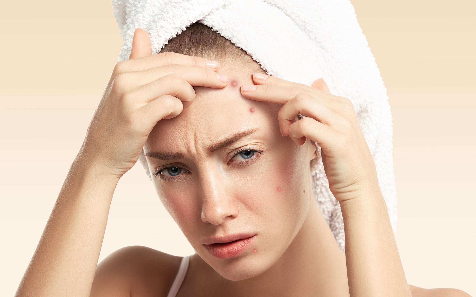Are Your Haircare Products Causing Acne Breakouts?